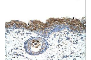 Image no. 1 for anti-Eukaryotic Translation Initiation Factor 2A, 65kDa (EIF2A) (AA 504-553) antibody (ABIN203306)