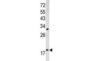Western blot analysis of ARF3 antibody and MCF-7 lysate