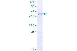Image no. 1 for Major Histocompatibility Complex, Class II, DR beta 3 (HLA-DRB3) (AA 1-266) protein (GST tag) (ABIN1306765)