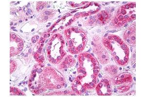 Image no. 1 for anti-Solute Carrier Family 6 (Neurotransmitter Transporter, GABA), Member 11 (SLC6A11) (C-Term) antibody (ABIN346946)