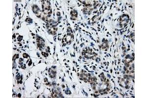 Immunohistochemical staining of paraffin-embedded breast tissue using anti-GRIPAP1 mouse monoclonal antibody. (GRIPAP1 anticorps)