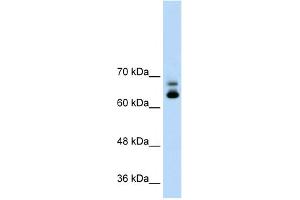 WB Suggested Anti-MTA2 Antibody Titration:  1.