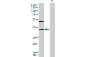 Western Blot analysis of KDELR2 expression in transfected 293T cell line by KDELR2 MaxPab polyclonal antibody. (KDELR2 anticorps  (AA 1-212))