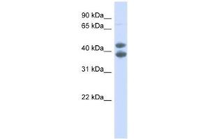 Western Blot showing SOX4 antibody used at a concentration of 1.