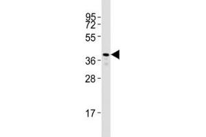 Western blot testing of Rho antibody at 1:2000 dilution + zebrafish muscle lysate; Predicted molecular weight: 40 kDa.