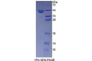 SDS-PAGE analysis of Mouse SNUPN1 Protein. (Snurportin 1 Protein (SNUPN))