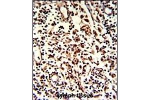 Formalin-fixed and paraffin-embedded human lymph with BARON Antibody (N-term), which was peroxidase-conjugated to the secondary antibody, followed by DAB staining. (Rubicon anticorps  (N-Term))