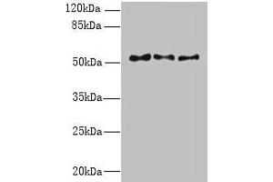Western blot All lanes: TRIML1 antibody at 3 μg/mL Lane 1: Mouse kidney tissue Lane 2: Human placenta tissue Lane 3: A431 whole cell lysate Secondary Goat polyclonal to rabbit IgG at 1/10000 dilution Predicted band size: 54 kDa Observed band size: 54 kDa (TRIML1 anticorps  (AA 277-468))
