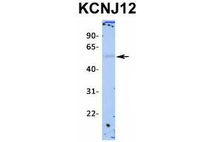 Host:  Rabbit  Target Name:  KCNJ12  Sample Type:  Human Adult Placenta  Antibody Dilution:  1.