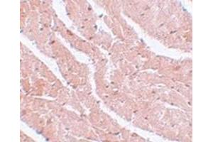 Immunohistochemical staining of mouse heart tissue with MTUS2 polyclonal antibody  at 5 ug/mL dilution. (CAZIP anticorps  (C-Term))
