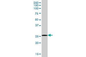 SSPN MaxPab polyclonal antibody.