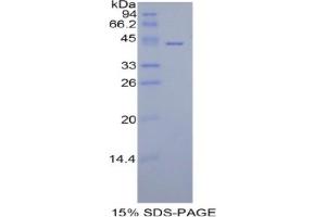 SDS-PAGE analysis of Human HIST1H2AA Protein. (HIST1H2AA Protéine)