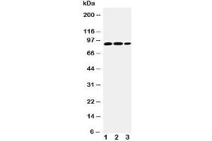 Western blot testing of STAT4 antibody and Lane 1:  rat testis;  2: human U87;  3: (h) HeLa cell lysate