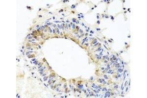Immunohistochemistry of paraffin-embedded Mouse lung using MUC16 Polyclonal Antibody at dilution of 1:100 (40x lens). (MUC16 anticorps)