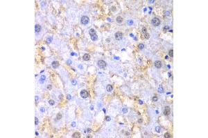 Immunohistochemistry of paraffin-embedded human liver injury using FAH antibody. (FAH anticorps)