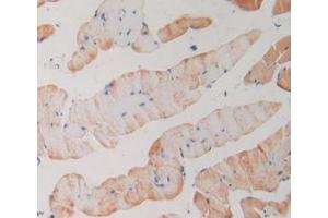 IHC-P analysis of Mouse Skeletal Muscle Tissue, with DAB staining. (PLA2R1 anticorps  (AA 1418-1487))