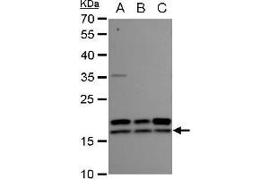 WB Image nm23-H2 antibody detects nm23-H2 protein by western blot analysis. (NME2 anticorps  (Center))