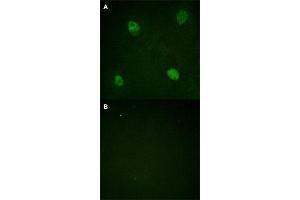 Immunofluorescence staining of methanol-fixed HeLa cells with HNRNPD (phospho S83) polyclonal antibody  without blocking peptide (A) or preincubated with blocking peptide (B) at 1:100-1:200 dilution. (HNRNPD/AUF1 anticorps  (pSer83))