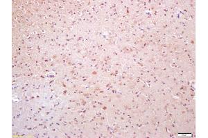 Formalin-fixed and paraffin embedded rat brain labeled with Anti-Phospho-TAK1(Thr184) Polyclonal Antibody, Unconjugated (ABIN746303) at 1:200 followed by conjugation to the secondary antibody and DAB staining