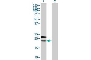 Western Blot analysis of PTTG1IP expression in transfected 293T cell line by PTTG1IP MaxPab polyclonal antibody. (PTTG1IP anticorps  (AA 1-180))