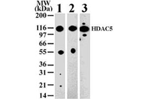 Western blot analysis of HDAC5 in 293 (lane 1) , Jurkat (lane 2) and NIH-3T3 (lane 3) cell lysate with HDAC5 polyclonal antibody  . (HDAC5 anticorps  (AA 572-587))