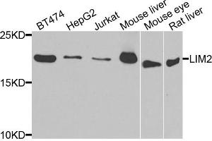 Western blot analysis of extracts of various cell lines, using LIM2 antibody. (LIM2 anticorps)