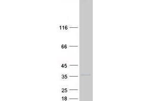 Validation with Western Blot