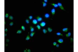 Immunofluorescence staining of Hela cells with ABIN7152772 at 1:96, counter-stained with DAPI. (FGF1 anticorps  (AA 16-155))