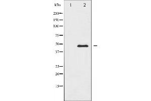 Western blot analysis of CaMK2 alpha/delta expression in NIH-3T3 whole cell lysates,The lane on the left is treated with the antigen-specific peptide. (CaMK2 alpha/delta anticorps)