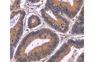 Immunohistochemistry (IHC) image for anti-Spermatogenesis Associated 7 (SPATA7) antibody (ABIN2428779) (SPATA7 anticorps)
