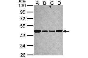 WB Image Sample (30 ug of whole cell lysate) A: 293T B: A431 , C: JurKat D: Raji 10% SDS PAGE antibody diluted at 1:1000 (NDUFS2 anticorps  (Center))