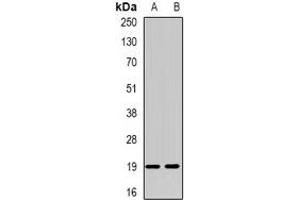 Western blot analysis of NUDT15 expression in HT29 (A), SW480 (B) whole cell lysates.