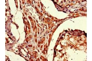 Immunohistochemistry of paraffin-embedded human testis tissue using ABIN7174691 at dilution of 1:100 (ARRDC1-AS1 (AA 1-176) anticorps)