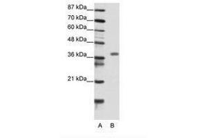 Image no. 1 for anti-Mesenchyme Homeobox 2 (MEOX2) (N-Term) antibody (ABIN202199) (MEOX2 anticorps  (N-Term))