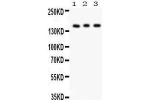 Anti- Insulin Receptor antibody, Western blotting All lanes: Anti Insulin Receptor at 0. (Insulin Receptor anticorps  (C-Term))