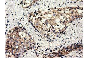 Image no. 9 for anti-ClpP Caseinolytic Peptidase, ATP-Dependent, Proteolytic Subunit Homolog (E. Coli) (CLPP) antibody (ABIN1497535)
