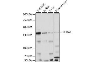 Western blot analysis of extracts of various cell lines, using PHK antibody (5700) at 1:1000 dilution. (PHKA1 anticorps  (AA 600-820))