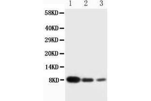 Anti-PF4 antibody, Western blotting Lane 1: Recombinant Human CXCL4 Protein 10ng Lane 2: Recombinant Human CXCL4 Protein 5ng Lane 3: Recombinant Human CXCL4 Protein 2. (PF4 anticorps  (C-Term))