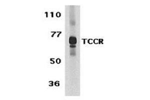 Western Blotting (WB) image for anti-Interleukin 27 Receptor, alpha (IL27RA) (C-Term) antibody (ABIN1030724) (IL27 Receptor alpha anticorps  (C-Term))