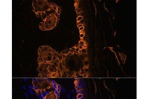 Immunofluorescence analysis of Rat skin using KRT14 Polyclonal Antibody at dilution of 1:100.