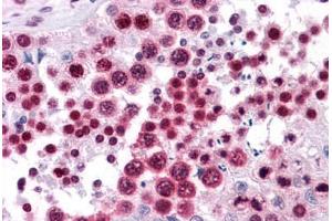 Human Testis: Formalin-Fixed, Paraffin-Embedded (FFPE) (HMGB2 anticorps  (AA 1-196))