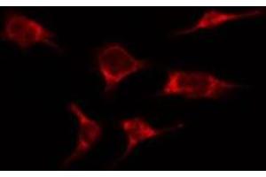 ABIN6276366 staining HepG2 by IF/ICC. (IL-2 anticorps  (Internal Region))