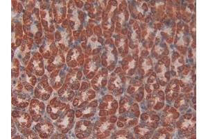 Detection of HK1 in Rat Stomach Tissue using Polyclonal Antibody to Hexokinase 1 (HK1)