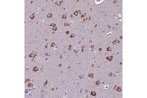 Immunohistochemical staining of human cerebral cortex with FAM173A polyclonal antibody  shows strong cytoplasmic positivity in neuronal cells. (FAM173A anticorps)