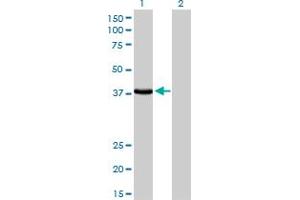 Western Blot analysis of EPM2A expression in transfected 293T cell line by EPM2A monoclonal antibody (M02), clone 6C6. (EPM2A anticorps  (AA 101-199))