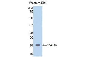 Western Blotting (WB) image for anti-Lysyl Oxidase-Like 2 (LOXL2) (AA 323-427) antibody (ABIN1859684) (LOXL2 anticorps  (AA 323-427))