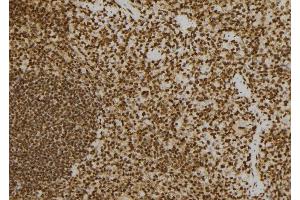 ABIN6277577 at 1/100 staining Mouse spleen tissue by IHC-P. (PRKRA anticorps  (Internal Region))