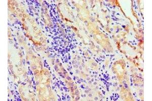 Immunohistochemistry of paraffin-embedded human kidney tissue using ABIN7144263 at dilution of 1:100