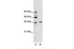 Image no. 1 for anti-Zinc Finger Protein 124 (ZNF124) (N-Term) antibody (ABIN202167) (ZNF124 anticorps  (N-Term))