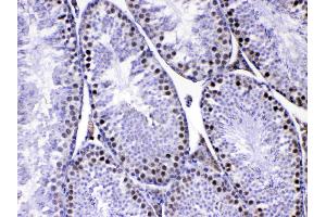 IHC analysis of MED8 using anti-MED8 antibody . (MED8 anticorps  (AA 1-195))